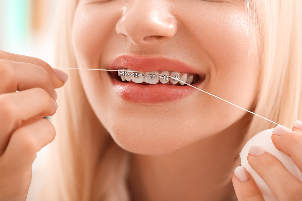 Tipos de hilo dental